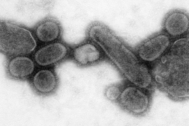 A spanyolnátha egykori áldozataiból nyert mintából kitenyésztett kórokozó elektronmikroszkópos képe (forrás: ORIGO)