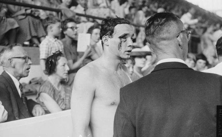 Zádor Ervin felszakadt szemöldökkel